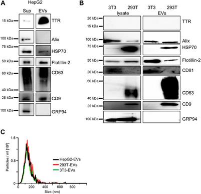 Extracellular Vesicles Contribute to the Metabolism of Transthyretin Amyloid in Hereditary Transthyretin Amyloidosis